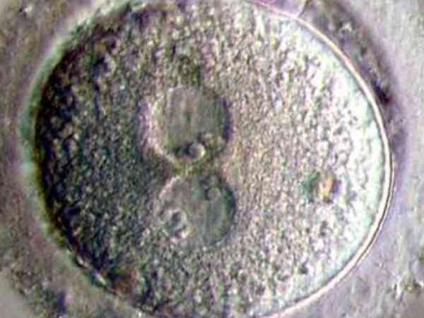 2pn胚胎是几级的胚胎