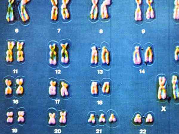 22号染色体异常还能要孩子吗