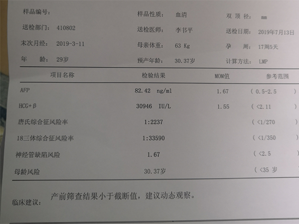 30岁唐筛基本过不了