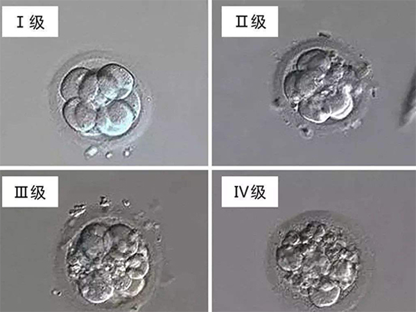 7c1级胚胎移植成功率高不高