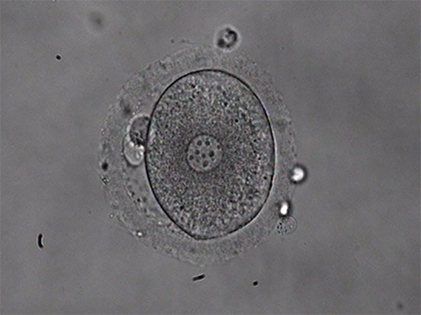 2pn胚胎移植成功率评估和优质胚情况分析