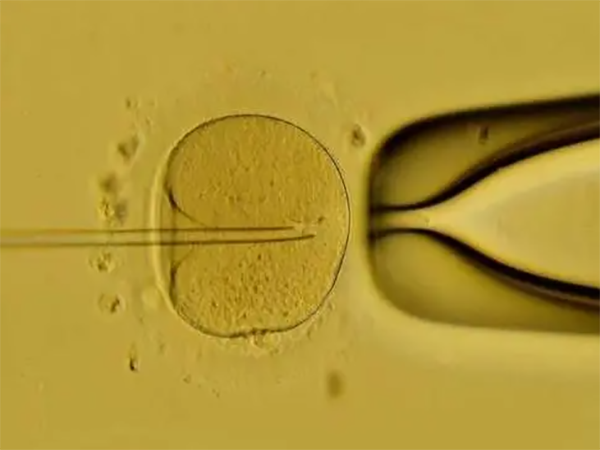 移植憋尿多不影响胚胎和试管成功率