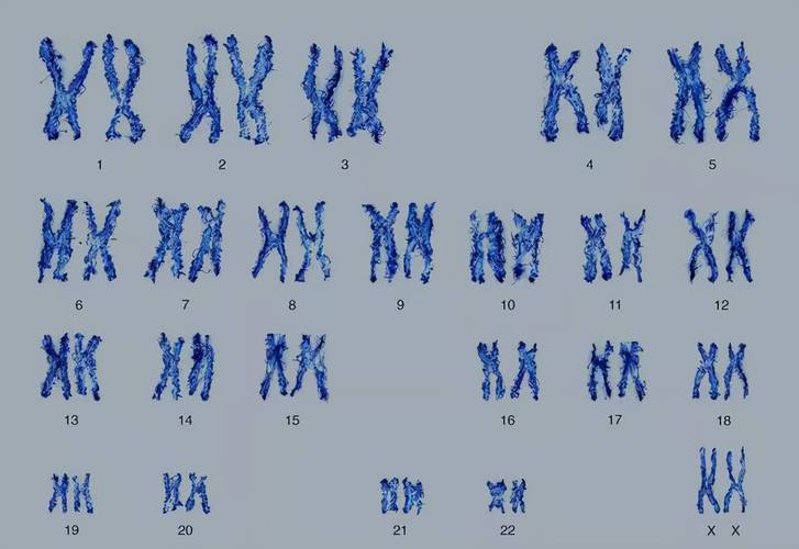 染色体核型分析正常结果