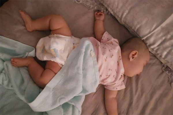 脑瘫婴儿睡姿图片