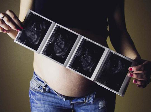 孕妇小排畸检查流程