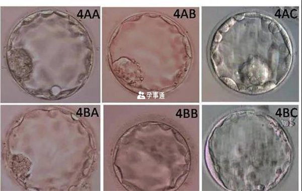 1级和2级囊胚属于优质胚胎