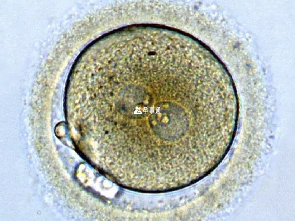 2pn胚胎是移植的首选