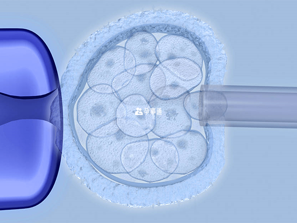 染色体异常生育健康宝宝可借助第三代试管技术