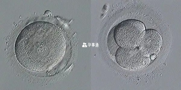 1pn胚胎是异常受精的