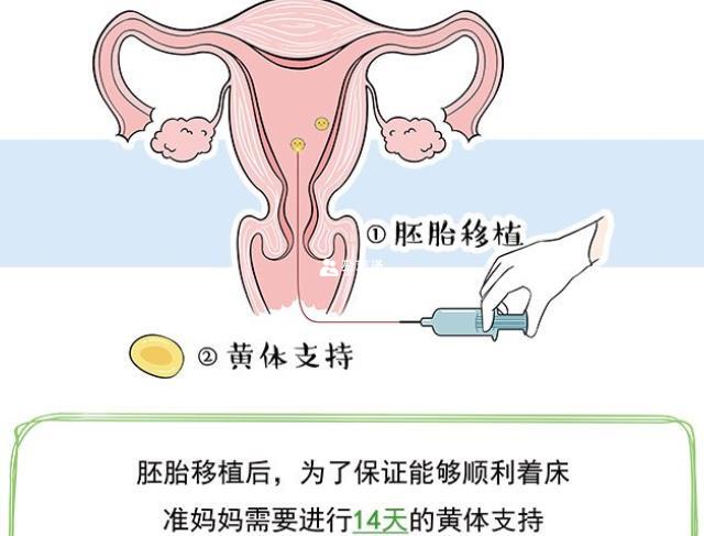 在培養液中形成受精卵之後進行胚胎移植