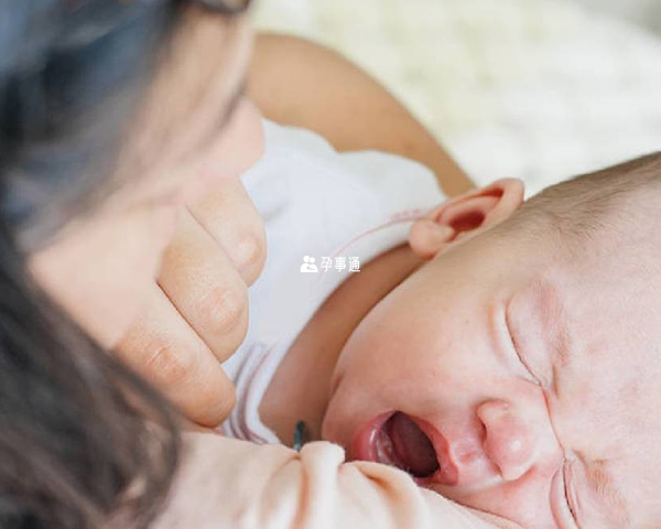 婴儿斜颈是指宝宝的头部向一侧偏斜