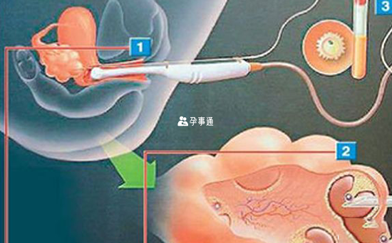 進行探針