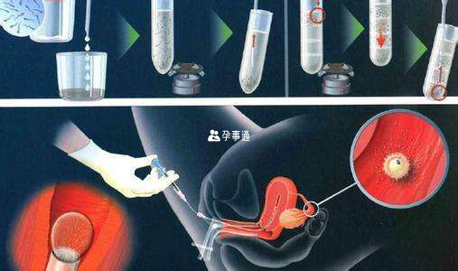 胚胎移植过程图