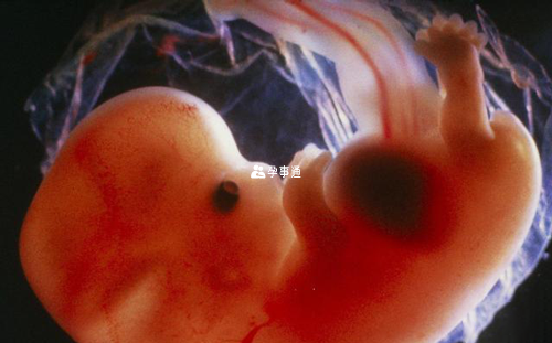 胚胎移植后出血常见原因
