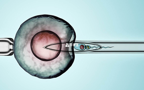 胚胎植入前筛查即第一代试管婴儿