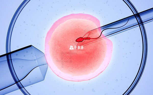 16个卵泡试管婴儿成功率计算