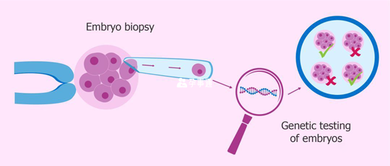 第三代试管婴儿技术PGD