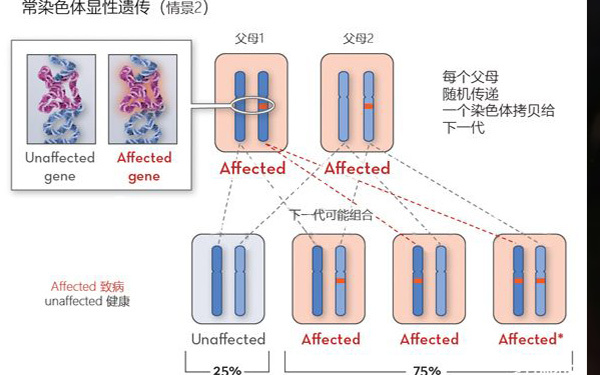 軟骨發育不全遺傳風險