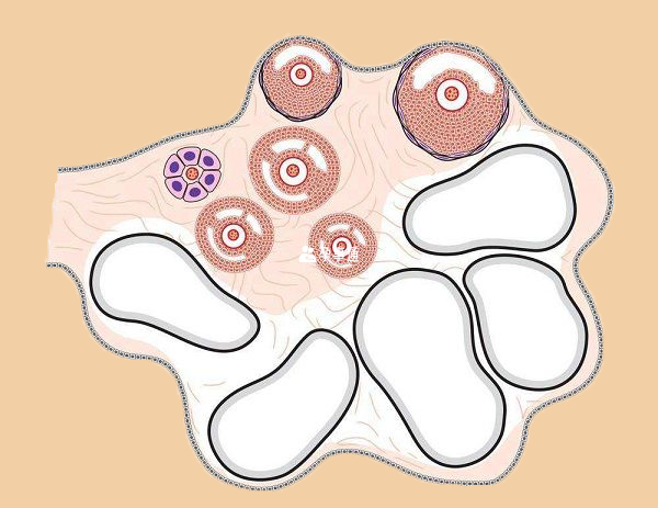 闭锁卵泡图片