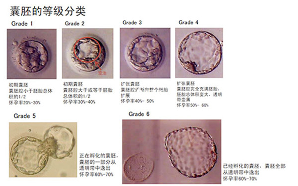 囊胚的等級分類