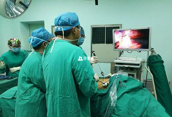 腹腔镜联合手术