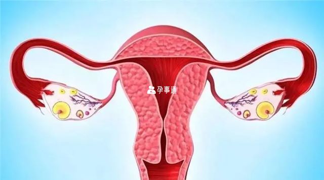 宫外孕前的六种征兆