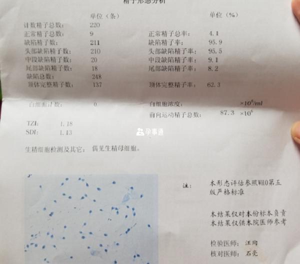 鼓樓醫院做的精子碎片檢查