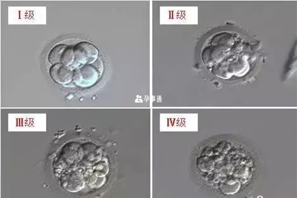 胚胎主要分为4个等级