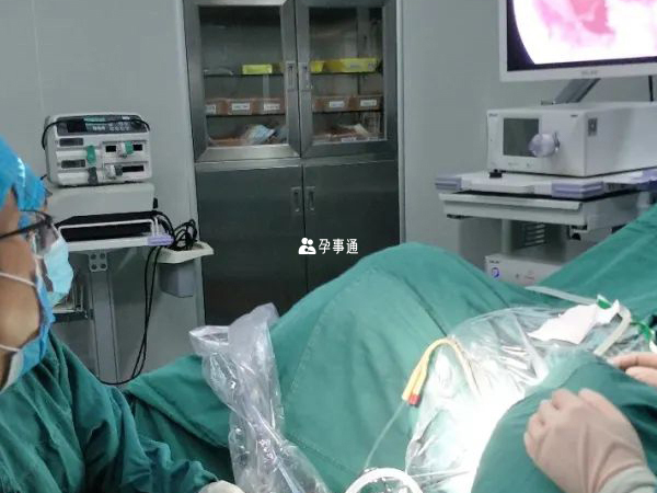 广州输卵管复通手术费用明细