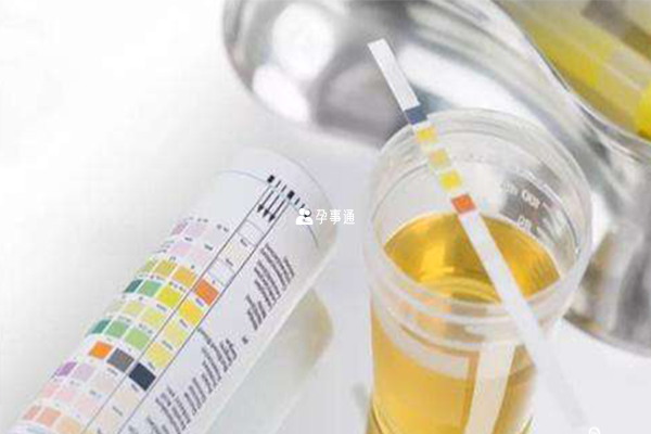 尿酸碱度可通过滴试法进行检测