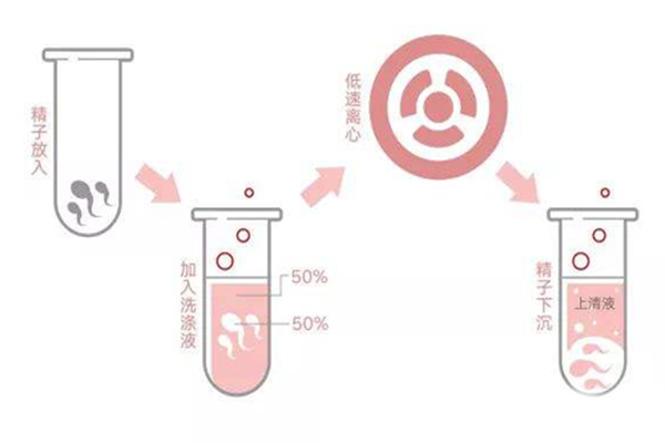 男性乙肝阳性可通过洗精术找出健康精子