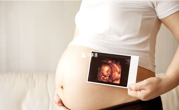 孕妇做四维彩超可检查出大部分胎儿疾病