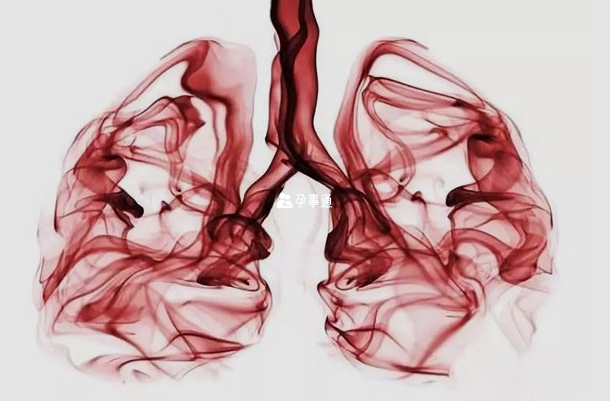 肺泡毛细血管发育不良