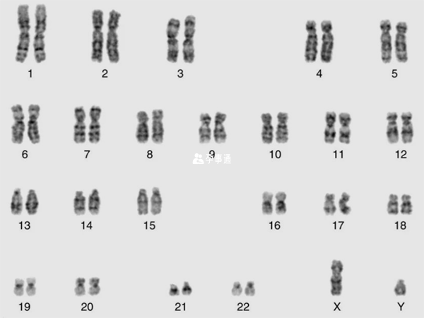 人体染色体图