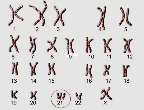 出现异常的21号染色体