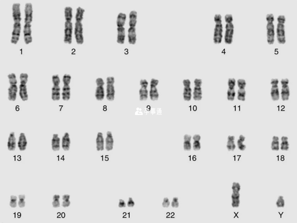 男性染色體圖