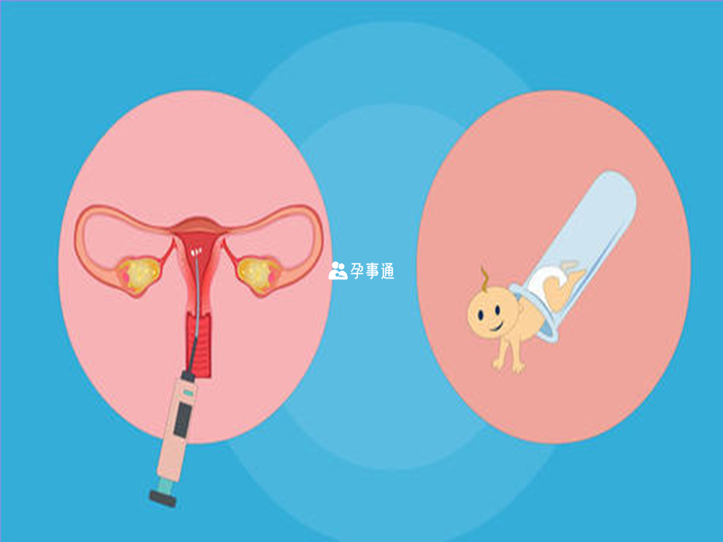 宏孕生殖医疗中心的第三代试管婴儿技术