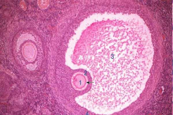 试管婴儿卵泡监测作用