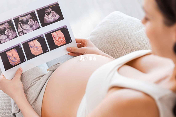 服用转胎药可能引起胎儿畸形