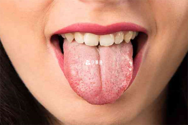 舌头看男女方法介绍