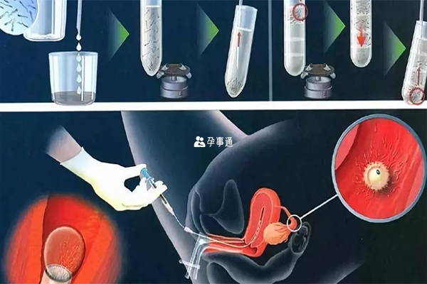 北醫三院自然週期流程介紹