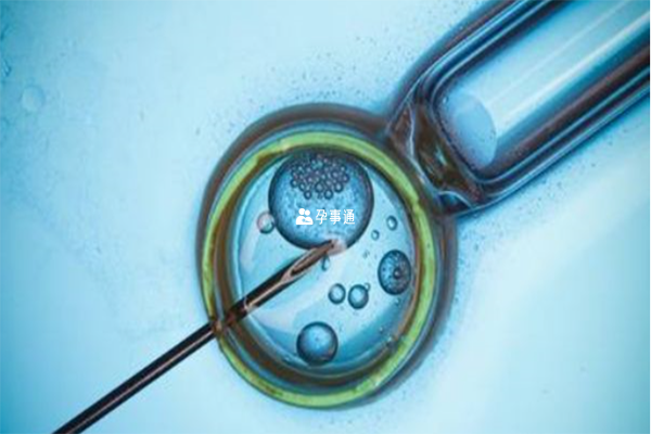 自然周期移植囊胚无需促排卵药物治疗