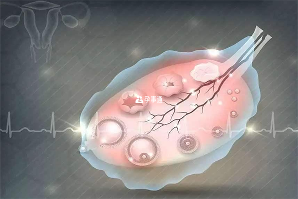 多囊卵巢的患者就可以通过促排卵来助孕
