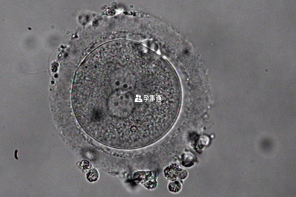 1pn胚胎分裂后可形成囊胚