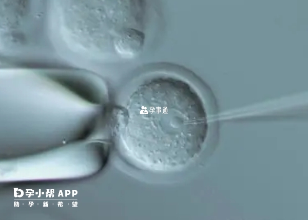 胚胎3pn能否移植生孩子得看具体情况