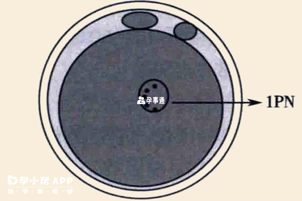 2pn胚胎養囊成功率較高