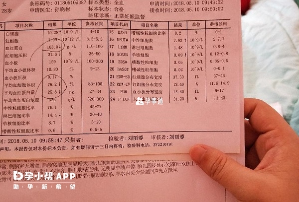 地中海貧血檢查報告單可判斷患病可能性