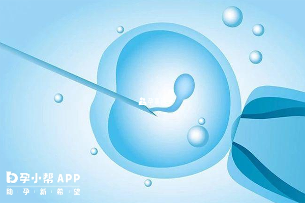 卵泡监测可以帮助快速生育孩子