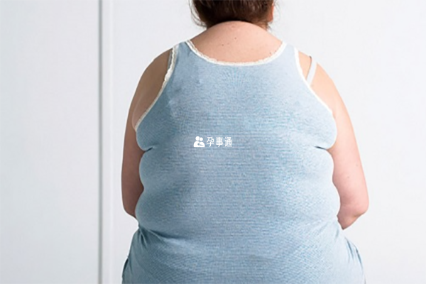 备孕女性要控制体型不能肥胖