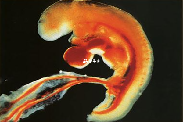 45岁怀孕胎儿容易出现染色体异常